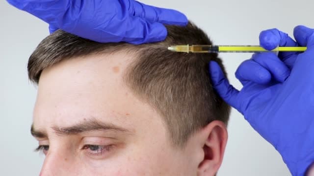Haartransplantation klinik bei männlichem Haarausfall: Ihre Fragen beantwortet