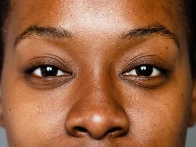 Premium exosomen kosmetik – MorySkin liefert Qualität deutschlandweit
