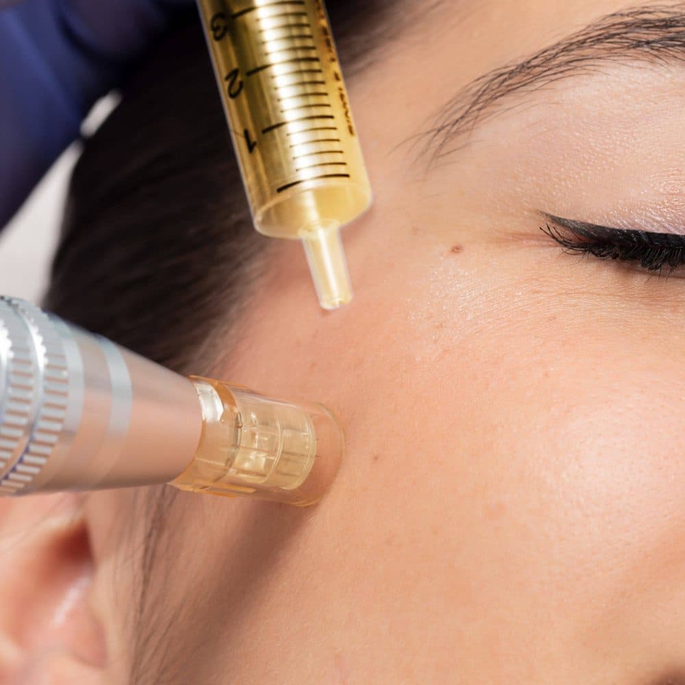 Botox Nürnberg: Sicher und professionell – die besten Anbieter in Nürnberg